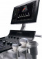 Аппарат УЗИ (сканер) GE Healthcare Versana Essential - ViaMedis - 2