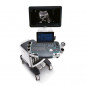 Аппарат УЗИ (сканер) Mindray Resona 7s - ViaMedis - 2
