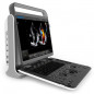 Аппарат УЗИ (сканер) Chison SonoTouch 60 Pro - ViaMedis