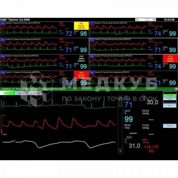 Станция мониторная центральная Treaton СЦМ2.24 - ViaMedis