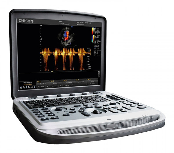 Аппарат УЗИ (сканер) Chison SonoTouch 80 Pro - ViaMedis