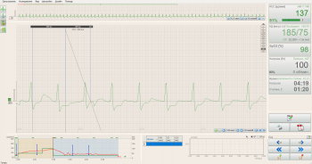 Стресс-система BTL CardioPoint-Ergo E300 на базе ЭКГ BTL-08 SD3 ECG с ПО для стресс-теста - ViaMedis