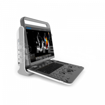 Аппарат УЗИ (сканер) Chison SonoTouch 60 Pro - ViaMedis