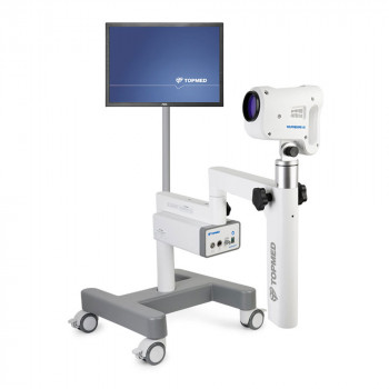 Цифровой видеокольпоскоп TOPMED Colposcope HD с компьютерной станцией для кольпоскопической диагностики и проводной педалью - ViaMedis