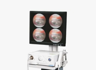 Эндоскопическая видеосистема Medstar Medvision для ЛОР-комбайна UE-3000 стационарная версия - ViaMedis