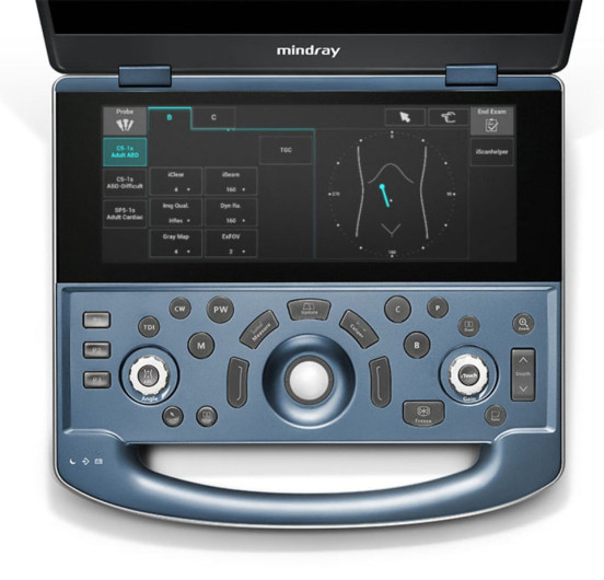 Аппарат УЗИ (сканер) Mindray MX8 Exp - ViaMedis