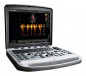 Аппарат УЗИ (сканер) Chison SonoTouch 80 Pro - ViaMedis