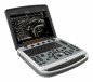 Аппарат УЗИ (сканер) Chison SonoTouch 80 Pro - ViaMedis - 2